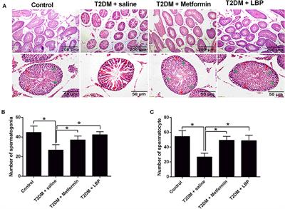 Lycium barbarum Polysaccharides Improve Testicular Spermatogenic Function in Streptozotocin-Induced Diabetic Rats